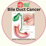 How Much Does Bile Duct Cancer Treatment Cost in India