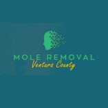 Mole Removal Camarillo
