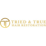 TNT Hair Restoration