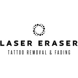 Laser Eraser: Laser Tattoo Removal