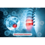 Bone Cancer Treatment