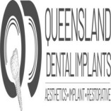 Queensland Dental Implants