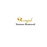 Tattoo Removal chennai