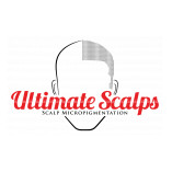 Ultimate Scalps