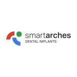Smart Arches Dental Implants - Monroe