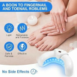 Fungabeam Toenail Fungus Device