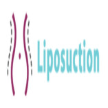 Liposuctionin Delhi