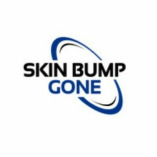 Skinbumpgone