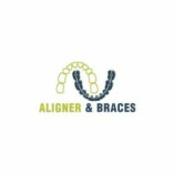 Aligner & Braces - Best Dentist in Delhi | Invisalign Braces Cost in Delhi | Metal Teeth Braces cost in Delhi | Aligners Cost