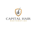 Capital Hair Restoration - Hair Transplant