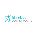 Mexico Dental Implants