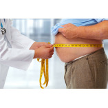 Obesity Surgery Antalya