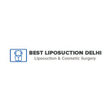 Best Liposuction Delhi