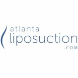 Atlanta Liposuction
