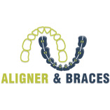 Aligner and Braces (ABC)