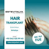 Hair Transplant