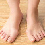 Hallux Valgus