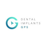 Dental Implants GPS