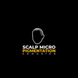 Scalp Micro Pigmentation Edmonton