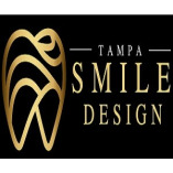 Smile Design Tampa