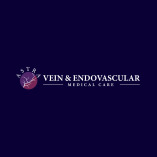 Varicose Veins Removal in Brooklyn, NY