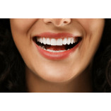 Ventura Bright Dental