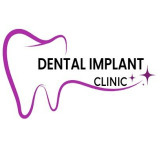 Affordable Dental Implants Phoenix