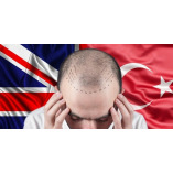 Turkey Hair Transplant