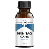 Charm Health Skin Tag Remover Review