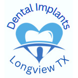 Dental Implants Longview TX