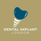 dentalimplantslondon