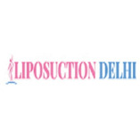 Liposuction Delhi