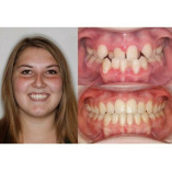 Silcox Orthodontics