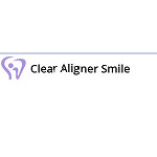 Clear Aligner Smile