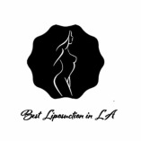 Best Liposuction