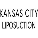 KANSAS CITY LIPOSUCTION