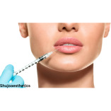 Mesotherapy Skin Boosters