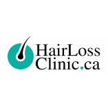 HAIRLOSSCLINIC.CA | Scalp Micropigmentation & Trichology Centre