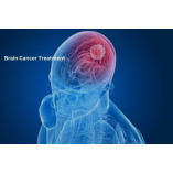 Brain Cancer Treatment