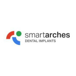 Smart Arches Dental Implants - Langhorne