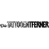 tattooentferner