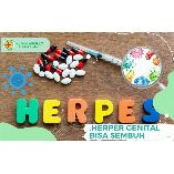 Pengobatan Herpes Genital