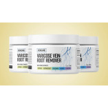 Veincare Varicose Vein Root Remover