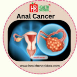 Anal Cancer Treamment in india : Process and Cost