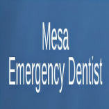 Dental Emergency Mesa