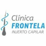 Clínica Frontela Injerto Capilar