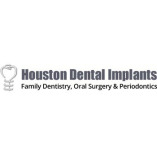 Houston Dental Implants Family Dentistry Oral Surgery And Periodontics