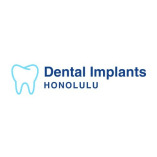 Dental Implants Honolulu