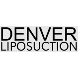 Liposuction Denver
